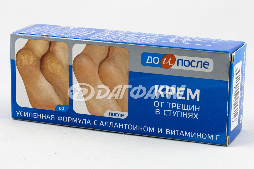 ДО И ПОСЛЕ крем от трещин в ступнях 50мл